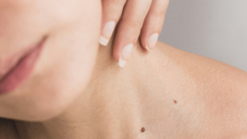 Dermatolog online – w czym może Ci pomóc?