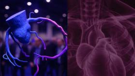 AI od Polaków w kardiologii. Medicalalgorithmics i Uniwersytet w Lund tworzą największy zbiór danych o funkcji serca