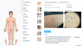 Polacy w półfinale globalnego konkursu. Ich rozwiązanie znalazło się wśród 20 najlepszych innowatorów z 62 krajów