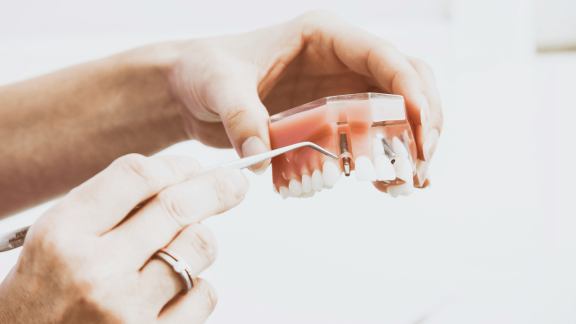 I pacjent szczęśliwy, i dentysta zadowolony: Microbite.xyz ze wsparciem The Heart i rozwiązaniem AI dla stomatologii