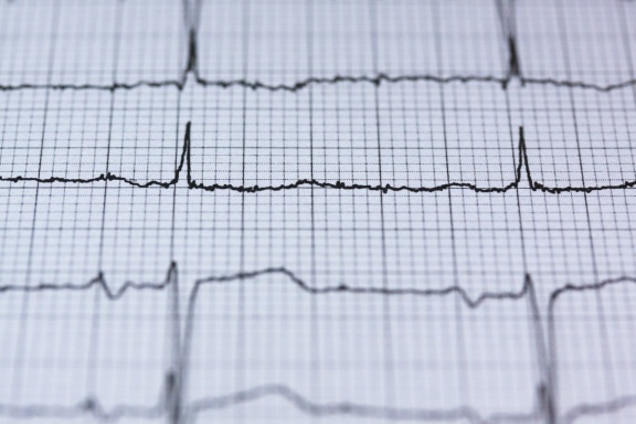 Opracowane przez polski startup elektrody pozwalają wykryć o 20% więcej zawałów serca niż klasyczne EKG