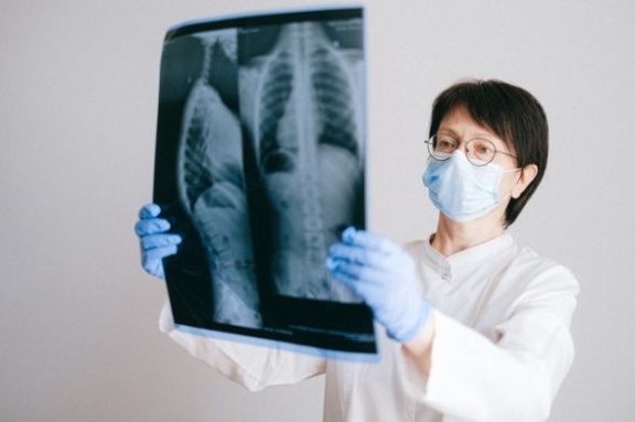 Urteste opracowało prototyp testu diagnostycznego na raka płuca
