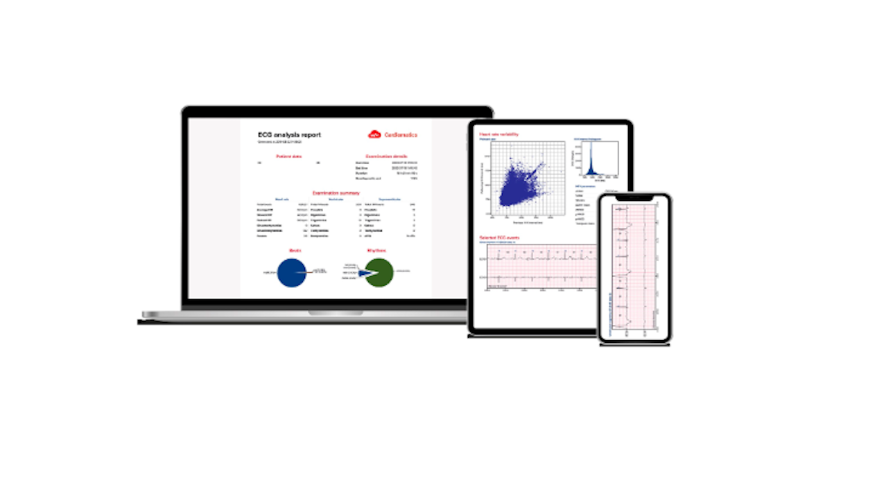 Cardiomatics uzyskał pierwszy na świecie certyfikat zgodności z MDR dla interpretacji EKG
