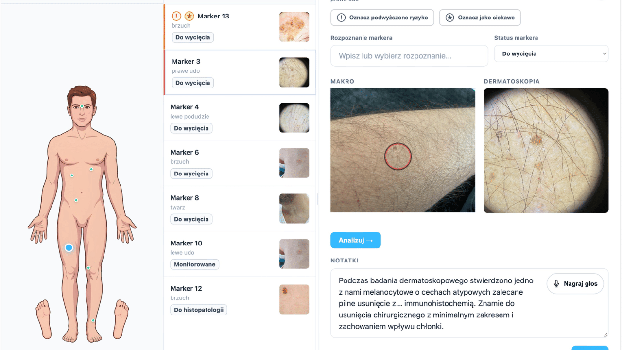 Polacy w półfinale globalnego konkursu Go Healthy with Taiwan. Rozwiązanie do wykrywania między innymi raka skóry wśród 20 najlepszych innowatorów z 62 krajów